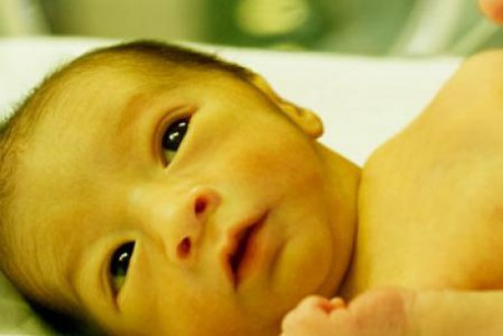 NHỮNG ĐIỀU CẦN BIẾT VỀ VÀNG DA SƠ SINH