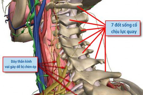 ĐAU VAI GÁY - BỆNH CỦA DÂN VĂN PHÒNG