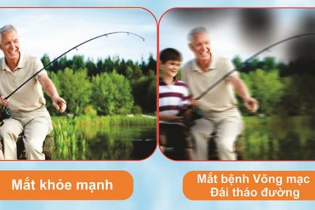 Bệnh võng mạc tiểu đường & những điều cần biết