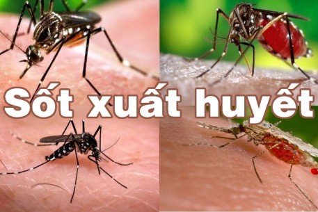 03 giai đoạn của Sốt xuất huyết