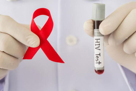 Quy trình thông báo kết quả xét nghiệm HIV dương tính