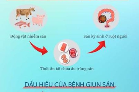 Không chủ quan với nhiễm giun sán, ký sinh trùng