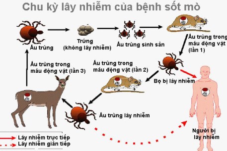 Những điều cần biết về bệnh Sốt mò