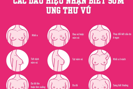 Tầm soát ung thư vú