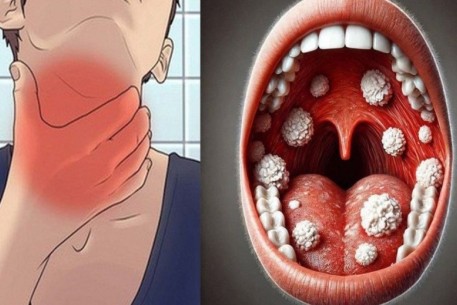 Tăng cường công tác phòng chống dịch bệnh mùa hè