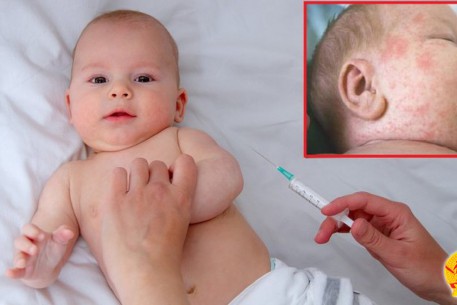 Mọi người dân kể cả người lớn tuổi chưa tiêm vắc xin phòng bệnh sởi cần đến ngay cơ sở y tế để tiêm phòng