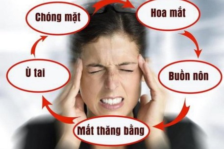 Rối loạn tiền đình và các giải pháp phòng ngừa