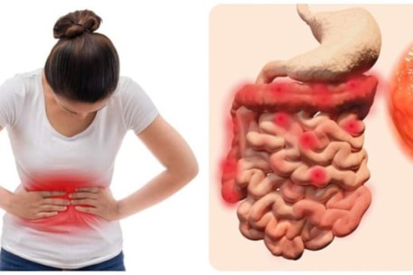 Những bất thường của cơ thể có thể là dấu hiệu cảnh báo ung thư