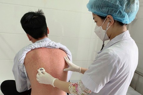 Cảnh báo bệnh Sởi ở người lớn