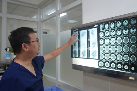 Cảnh báo đột quỵ xuất huyết não ở trẻ em