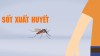 TÌNH HÌNH DỊCH BỆNH SXH TUẦN 17 (từ 23/4– 30/4/2018)