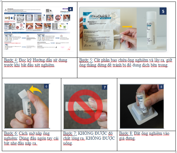 tự XN HIV 2