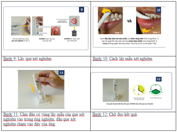tự XN HIV 3