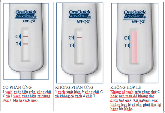 tự XN HIV 4