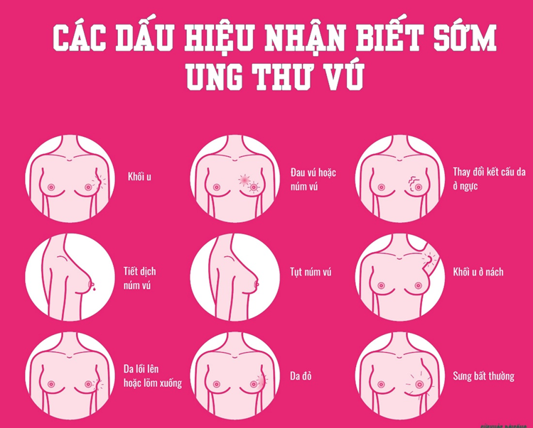 K vú