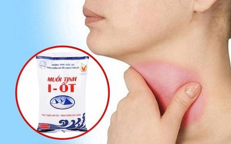 i ốt