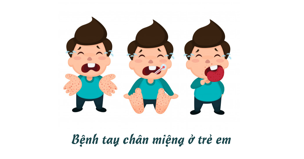 Benh TCM