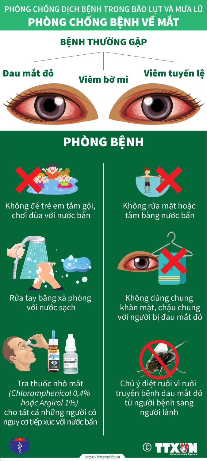 Đau mắt đỏ