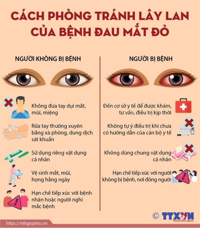 Phòng bệnh đau mắt đỏ