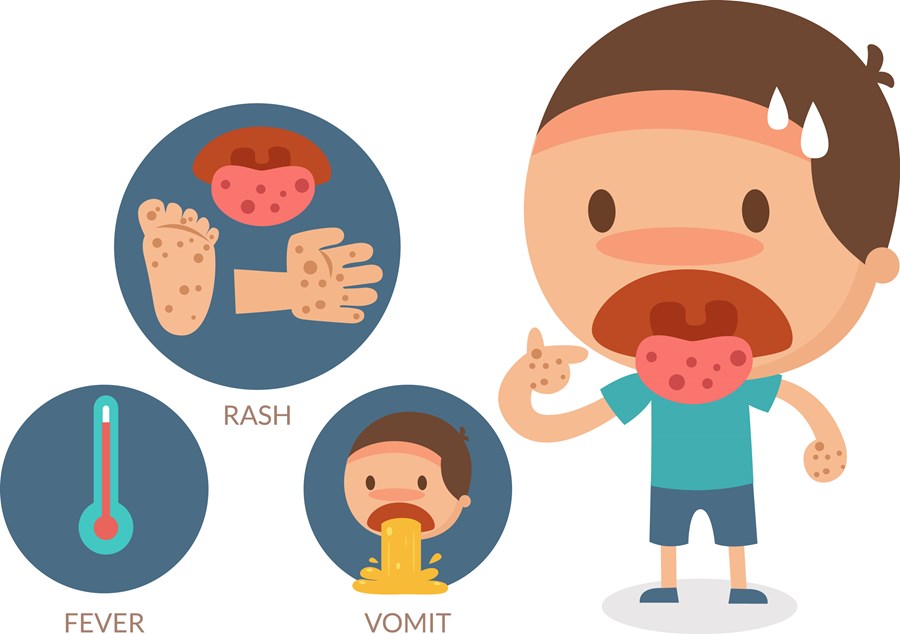 TÌNH HÌNH DỊCH BỆNH TCM VÀ CÁC BỆNH TRUYỀN NHIỄM KHÁC TUẦN 21 (từ 21/5– 27/5/2018)